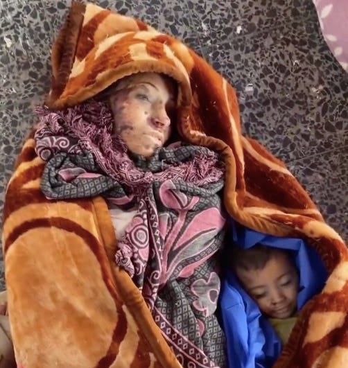Is "Israel Has a Right to Defend Itself" Code for "We Are Killing the Geneva Conventions"?