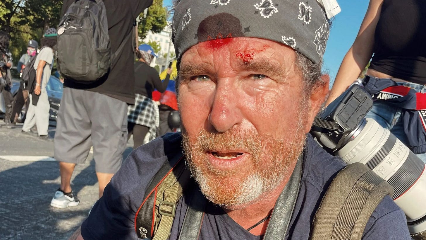 Terrifying moment Brit photographer films himself being shot in HEAD ... Terrifying moment Brit photographer films himself being shot in HEAD ...