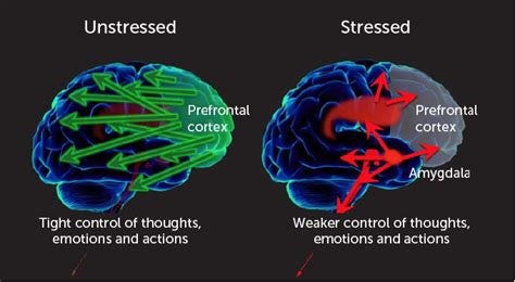 How stress affects your brain