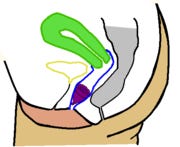 copa menstrual