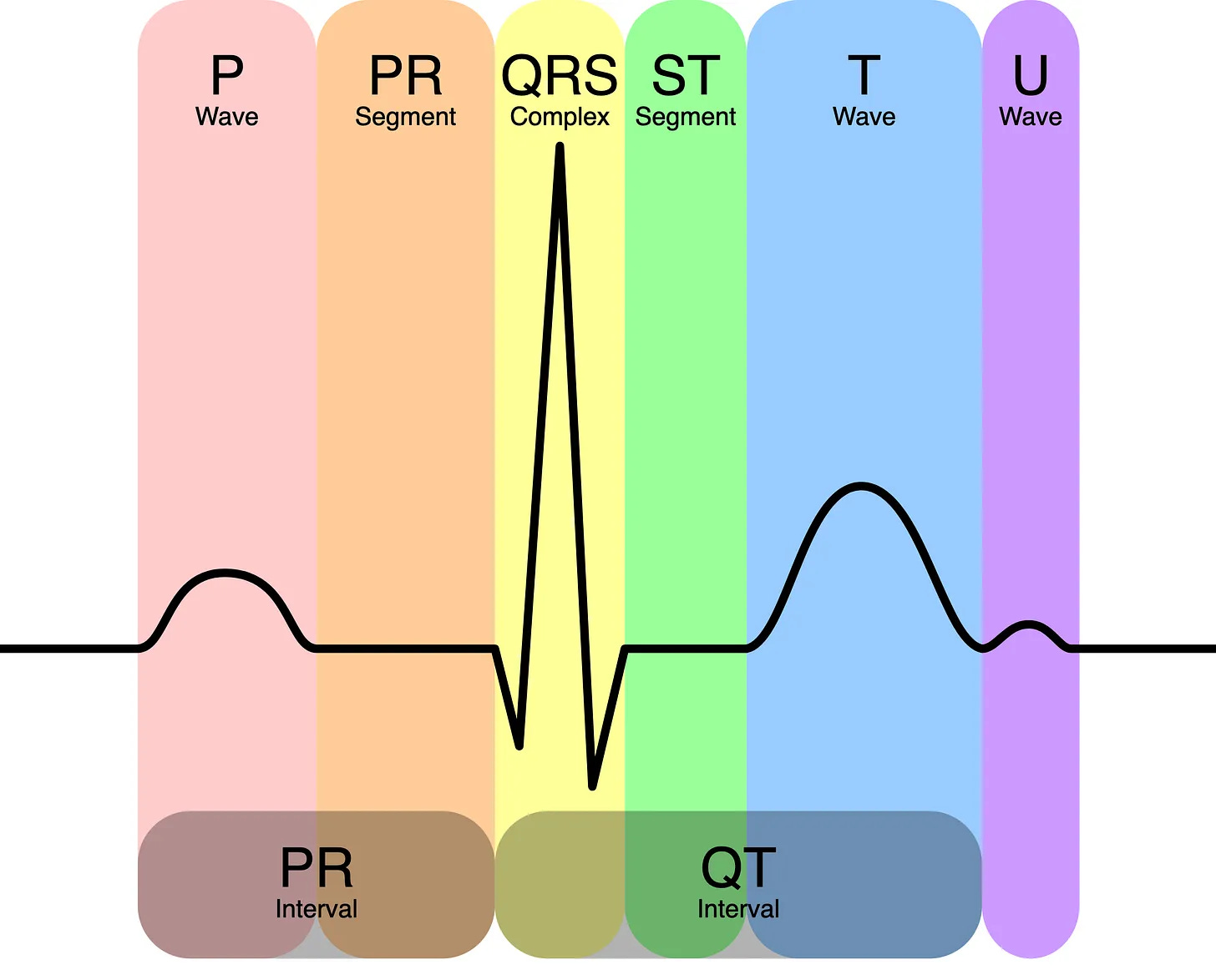 Schematic PQRST complex with colour-coded bands labelling all 7 ECG components — P wave, PR segment, QRS complex, ST segment, T wave, U wave, PR interval, and QT interval