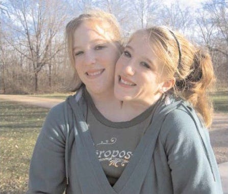 abigail_and_brittany_hensel