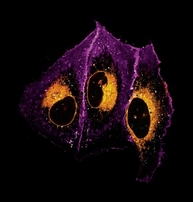 Microscope picture of human bone cells