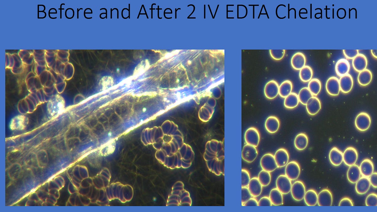 anamihalceamdphd.substack.com