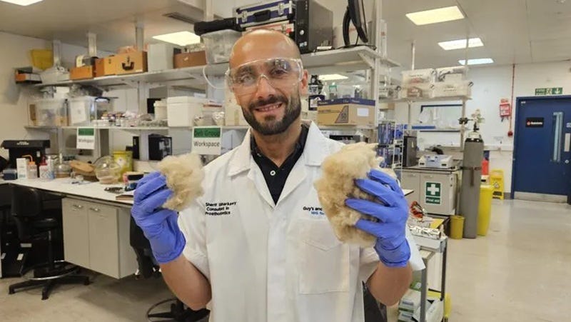 Dr Sherif Elsharkawy, consultant in prosthodontics at King's College London, holds up clumps of wool.
