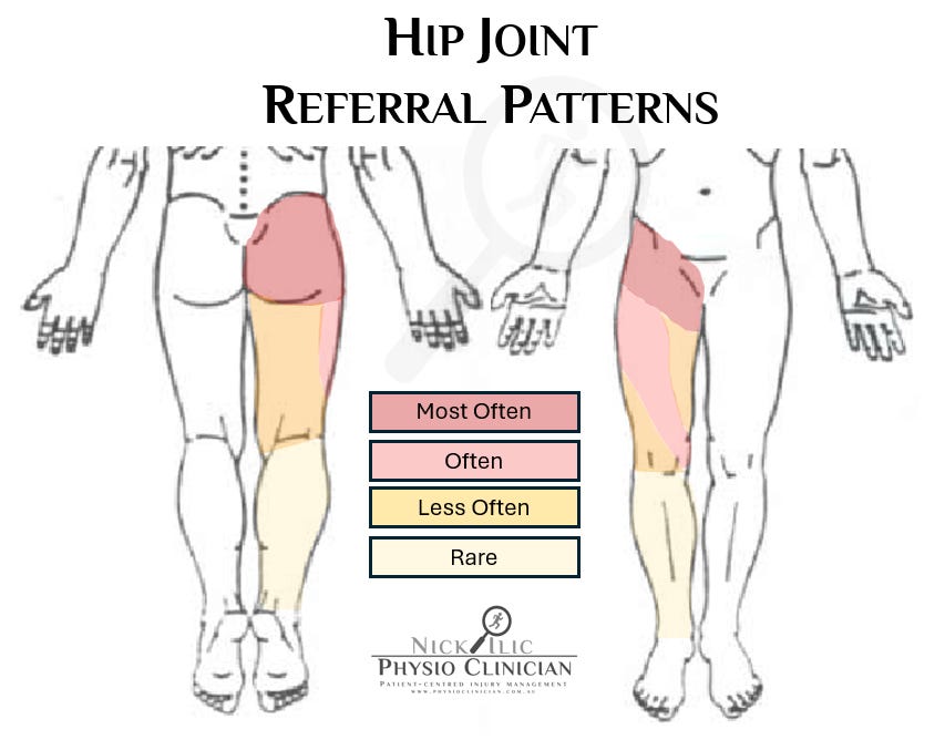 Psoas Pain Referral Pattern
