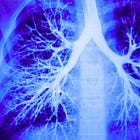 NIH Funds Creation of Chimeric H5N1 Virus That Replicates in Human Lung Cells, Resists Tamiflu, and Evolves to Evade Vaccines—Outside BSL-3 Containment