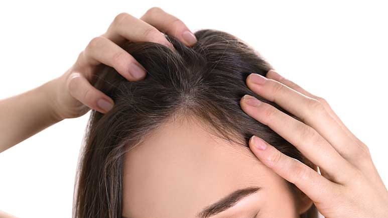 hair loss vitamins nutrients regrowth