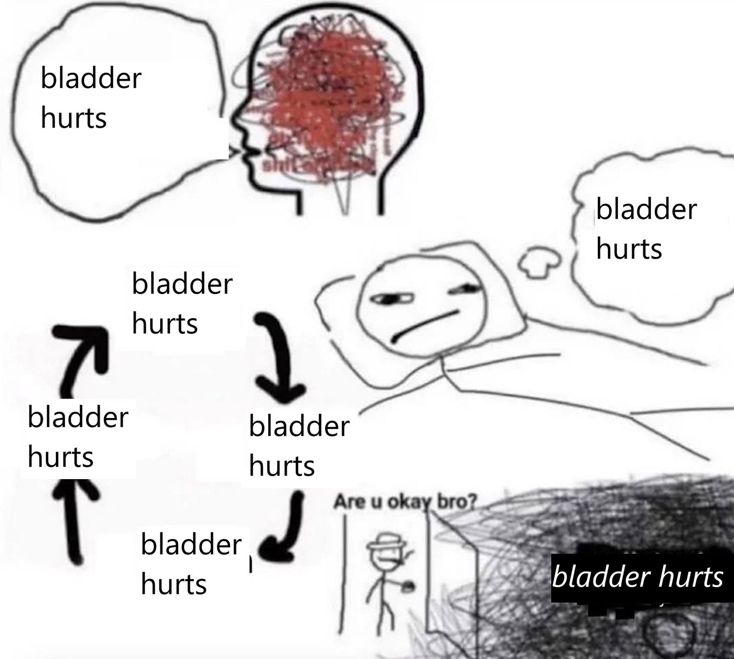 My bladder hurts My bladder hurts