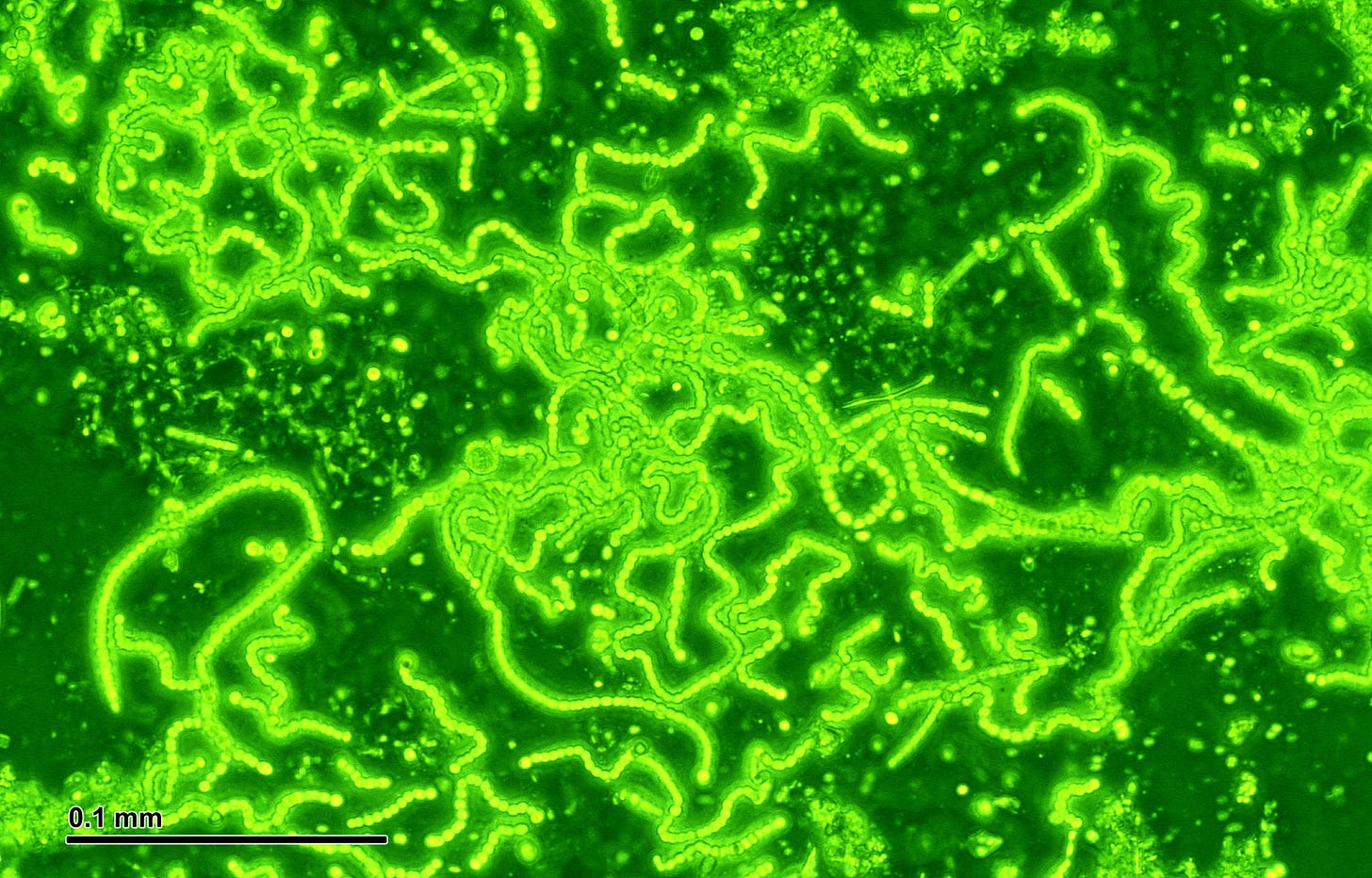 File:Cyanobacteria (248 08) Mixture; native preparation; green filter.jpg - Wikimedia Commons File:Cyanobacteria (248 08) Mixture; native preparation; green filter.jpg - Wikimedia Commons