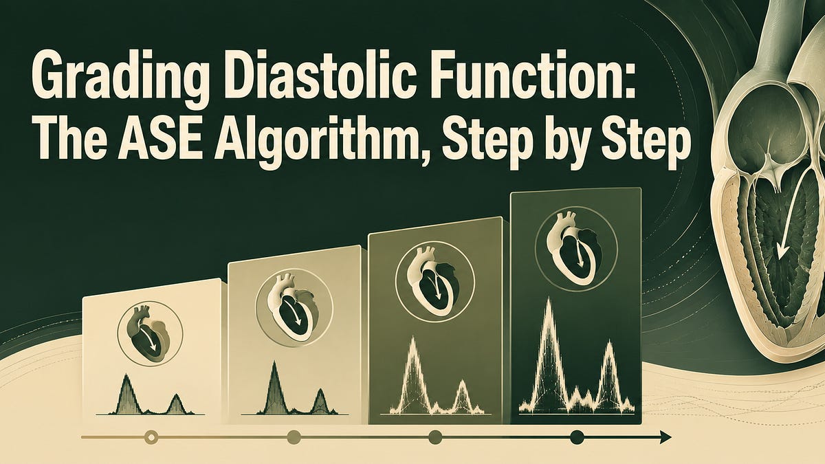 Grading Diastolic Function: The ASE Algorithm, Step by Step