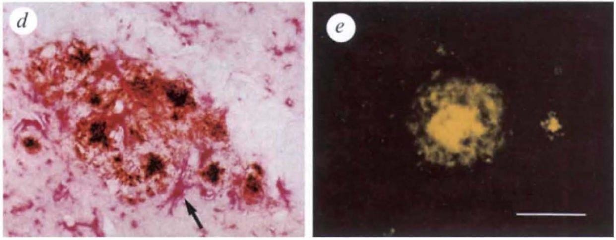 A close-up of a microscope

AI-generated content may be incorrect.