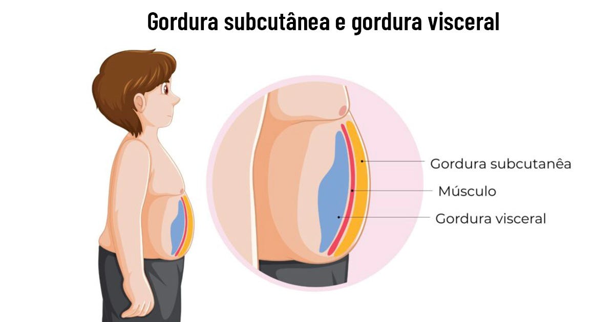 Desenho localizando a gordura visceral, envolvendo os órgãos Desenho localizando a gordura visceral, envolvendo os órgãos