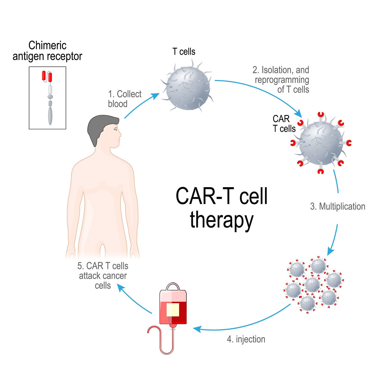 The step-by-step process of CAR T-cell therapy, AI generated The step-by-step process of CAR T-cell therapy, AI generated