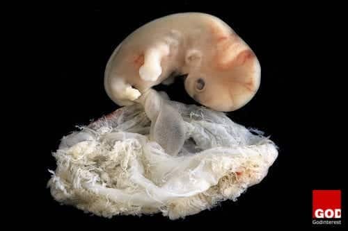 Embryo @ 6 - 7 weeks