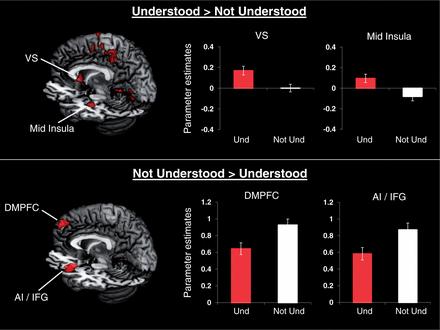 Neural activations for the contrast Understood > Not Understood and Not Understood > Understood, in addition to the parameter estimates for each region for Understood > Fixation and Not Understood > Fixation.