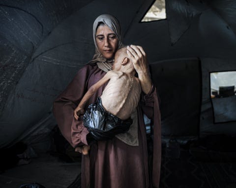 A one-and-a-half-year-old child in Gaza facing life-threatening malnutrition as the humanitarian situation worsens due to ongoing Israeli attacks and blockade. A one-and-a-half-year-old child in Gaza facing life-threatening malnutrition as the humanitarian situation worsens due to ongoing Israeli attacks and blockade.