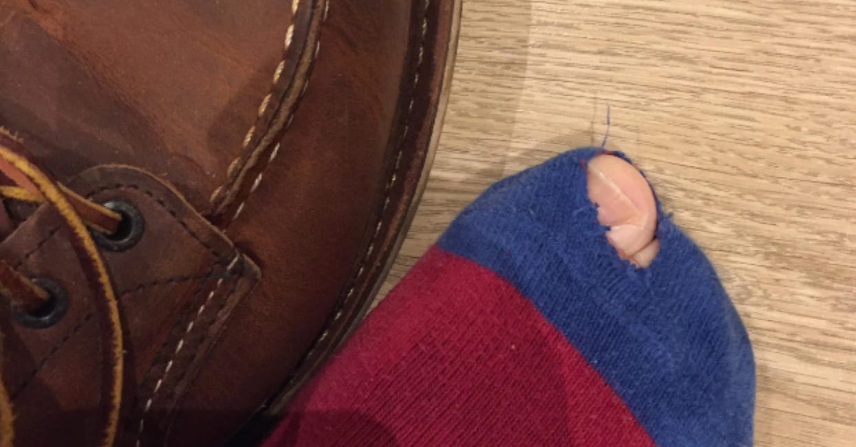 I showed my friend a picture of my toe