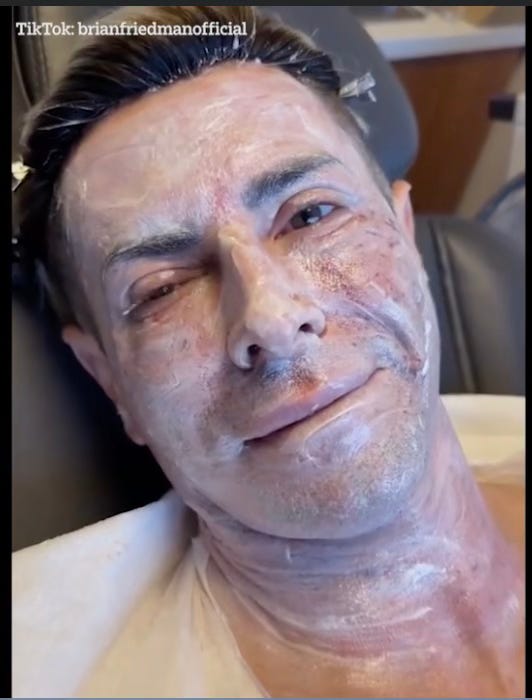 A man with cream all over his face, grimacing