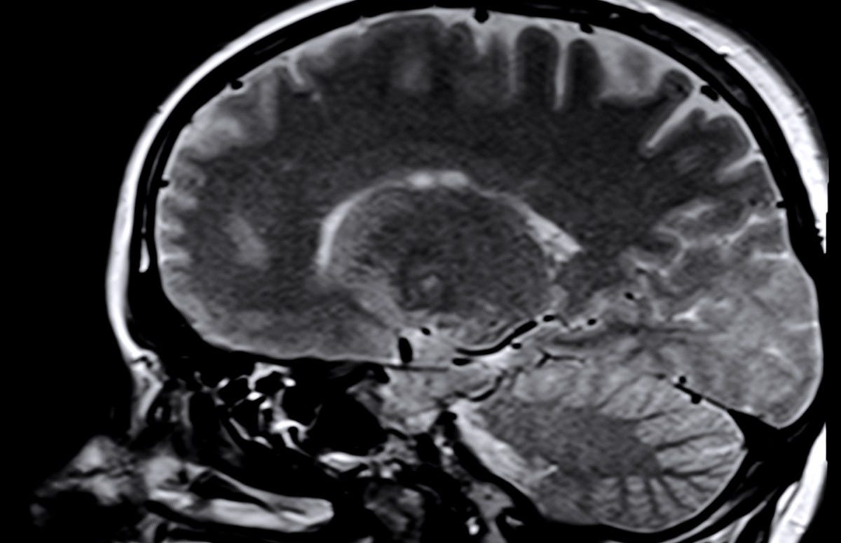 black and white, monochrome, arm, chest, human body, illustration, head, brain, organ, medical, x ray, monochrome photography, mrt, x ray image, medical imaging, medical radiography, magnetic resonance imaging black and white, monochrome, arm, chest, human body, illustration, head, brain, organ, medical, x ray, monochrome photography, mrt, x ray image, medical imaging, medical radiography, magnetic resonance imaging