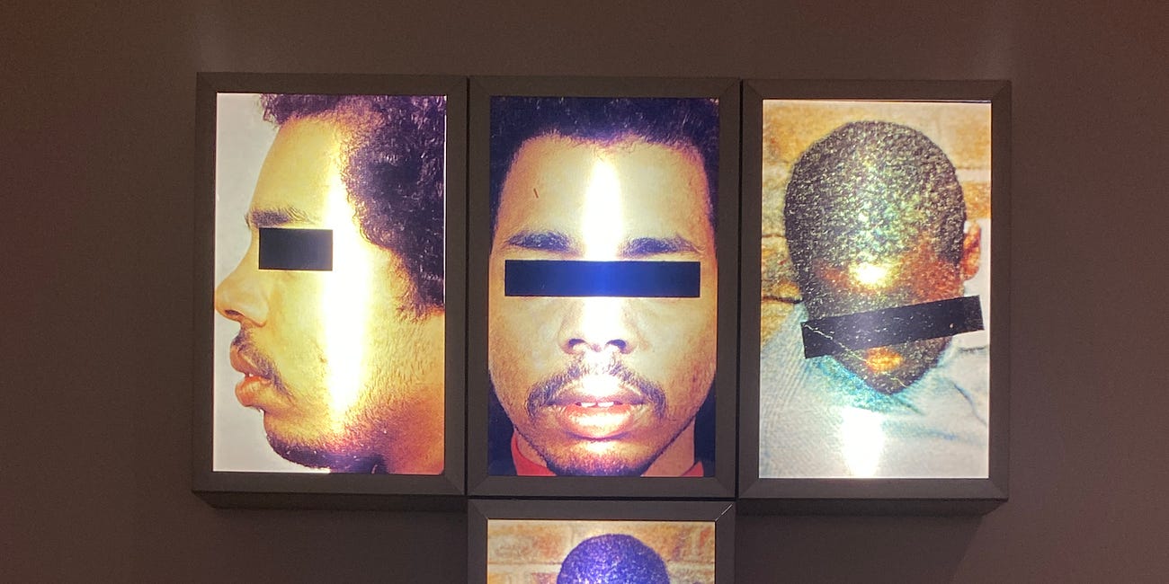 Visceral Canker: Donald Rodney Speaks Through Time at Whitechapel Gallery