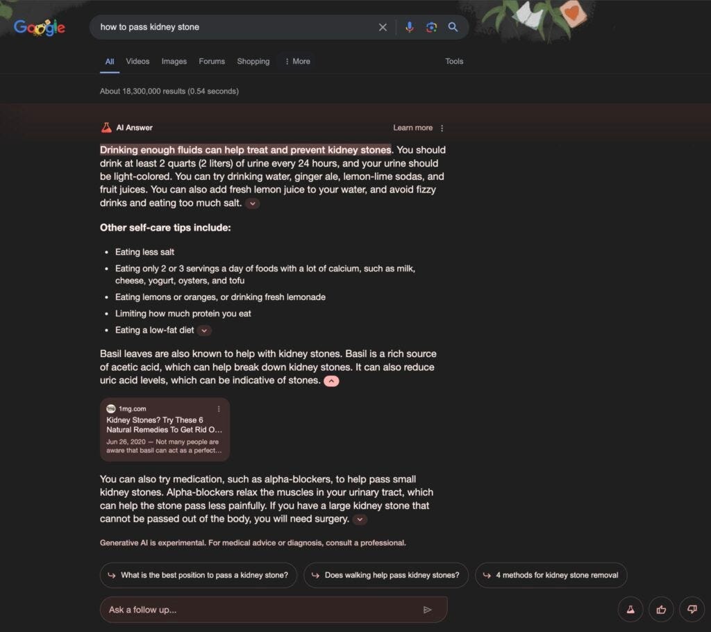 Google AI Overview answer about Kidney Stones
