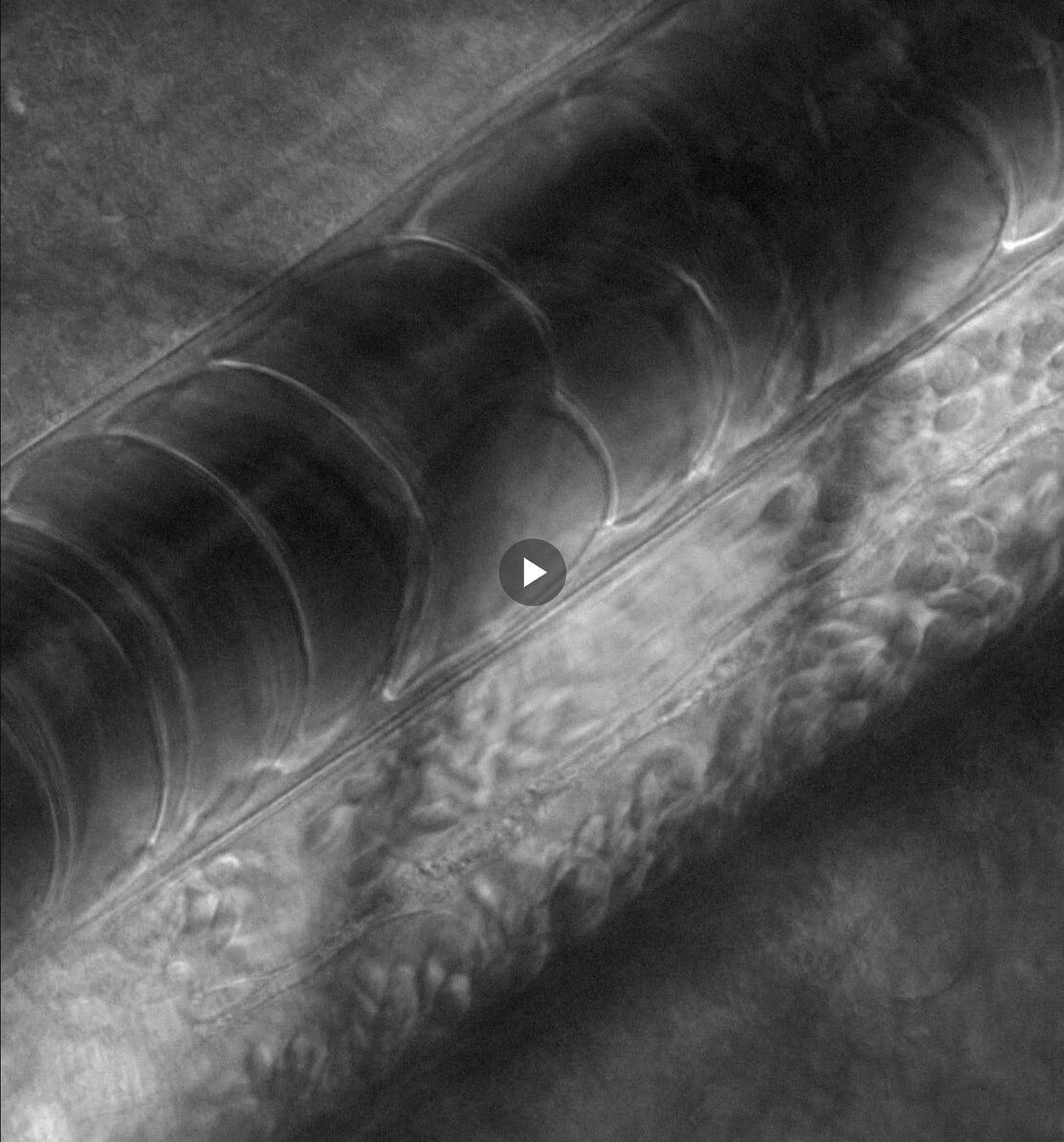Click the image to view the video on X. This is a high-resolution video of circulating blood.
