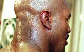Whatever happened to missing piece of ear from Tyson-Holyfield 'Bite  Fight'? Podcast dives into mystery - Yahoo Sports