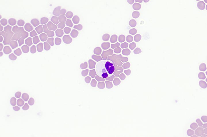 Anaplasma phagocytophilum morulae in neutrophils of dogs and cats on a peripheral blood smear northeast USA