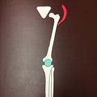 Common hip, knee, and ankle problems 