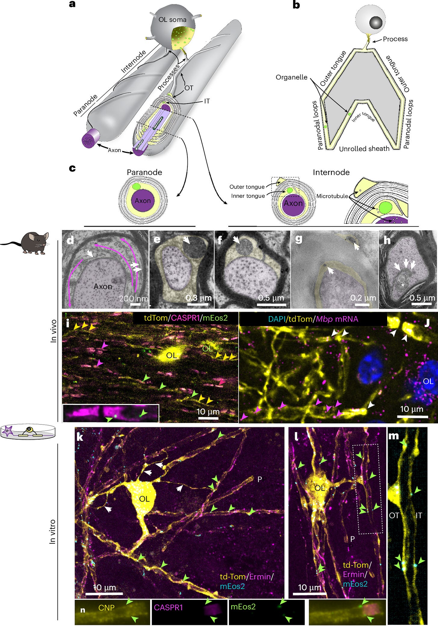 Fig. 1: Microtubules and membranous organelles in myelin’s cytoplasmic spaces.