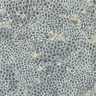 Pea peptide study, leaky gut and lipedema