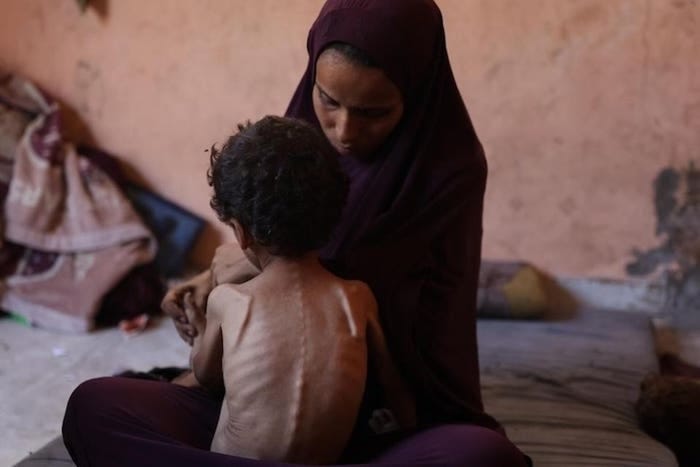 Children Are Dying As Famine Conditions Deepen In Gaza Strip