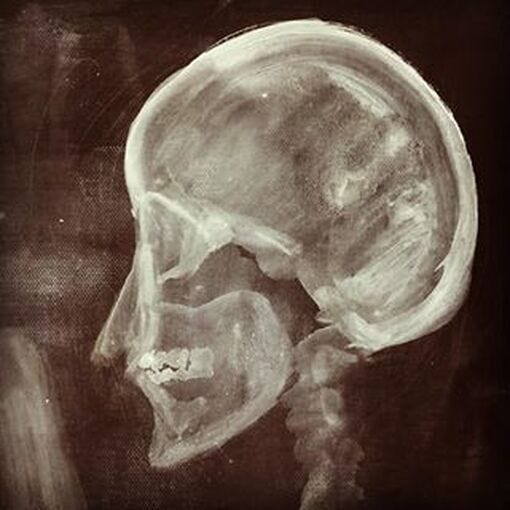 An X-ray