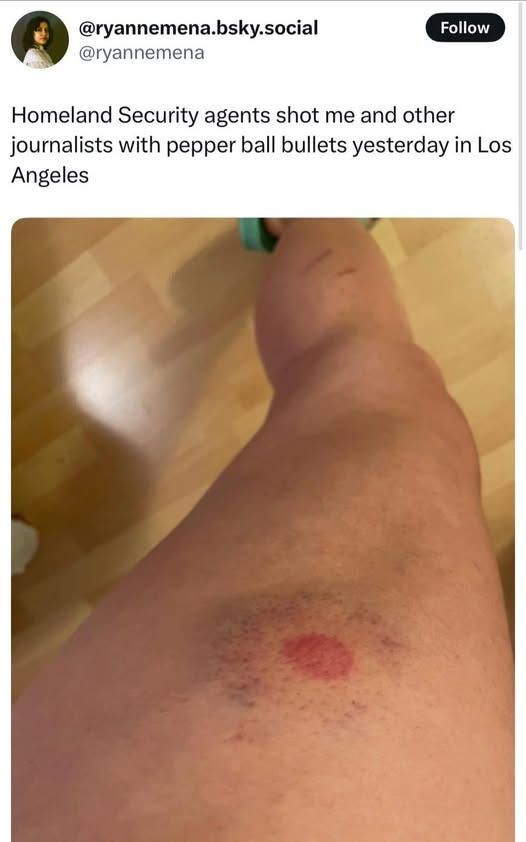 May be an image of 1 person and text that says '@ryannemena.bsky.social @ryannemena Follow Homeland Security agents shot me and other journalists with pepper ball bullets yesterday in Los Angeles' May be an image of 1 person and text that says '@ryannemena.bsky.social @ryannemena Follow Homeland Security agents shot me and other journalists with pepper ball bullets yesterday in Los Angeles'