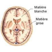 Matière grise et matière blanche du cerveau: définitions | Psychomédia