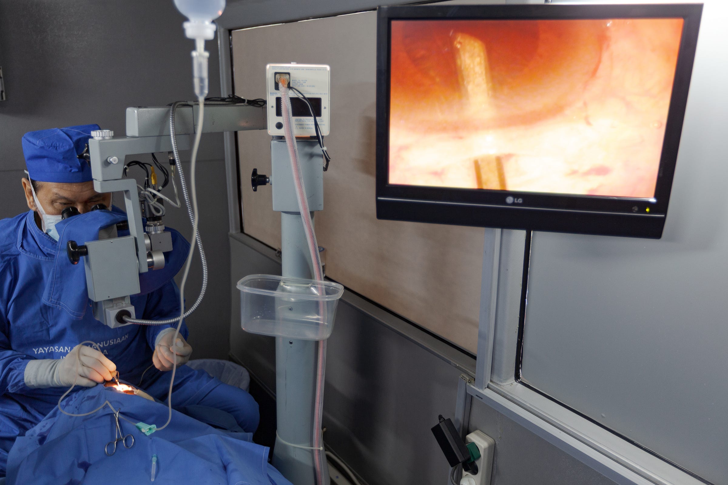 A small incision is made at the edge of the cornea A small incision is made at the edge of the cornea