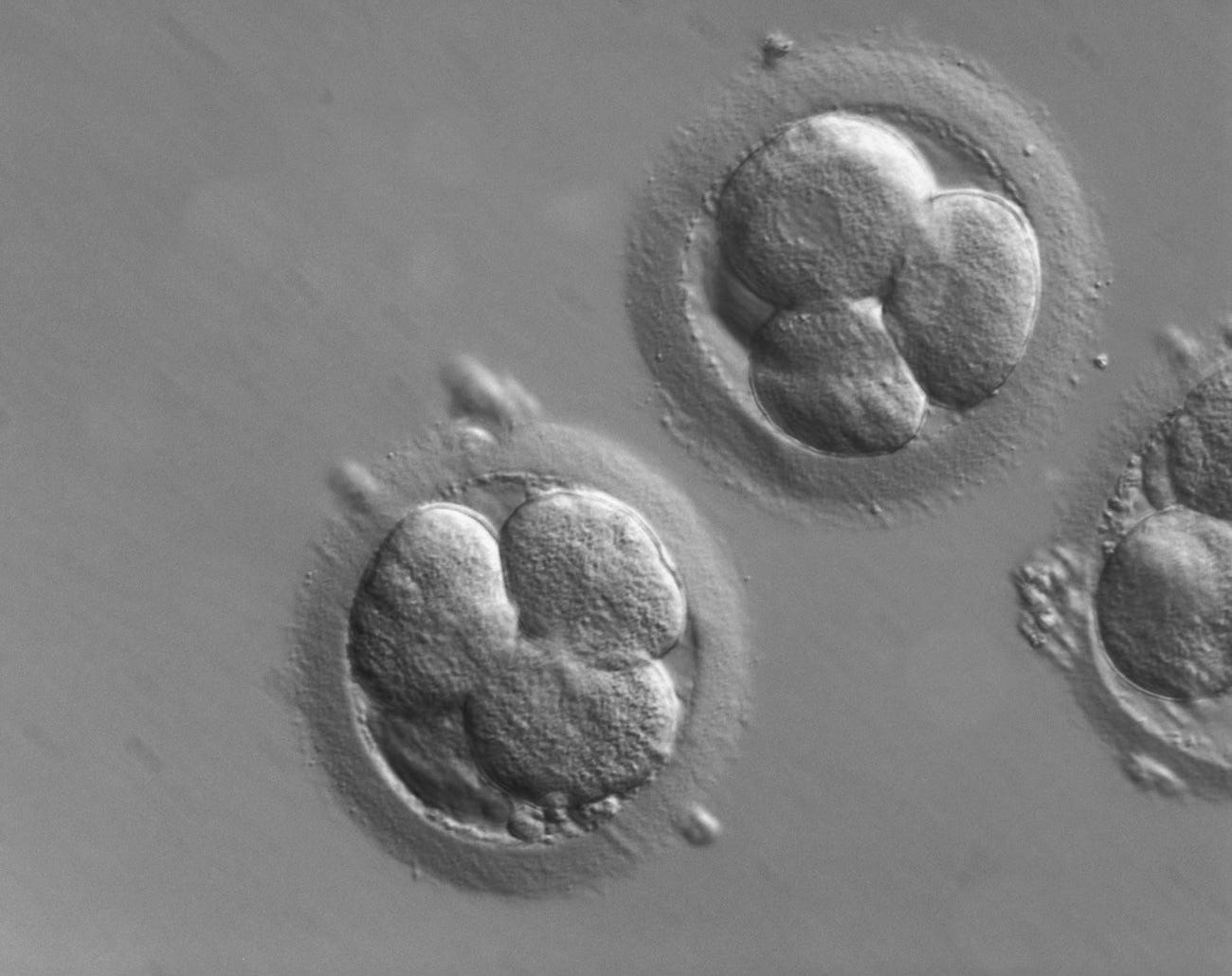CC-BY-licensed photo by Zeiss Microscopy. Original at https://www.flickr.com/photos/75834543@N06/27872285595