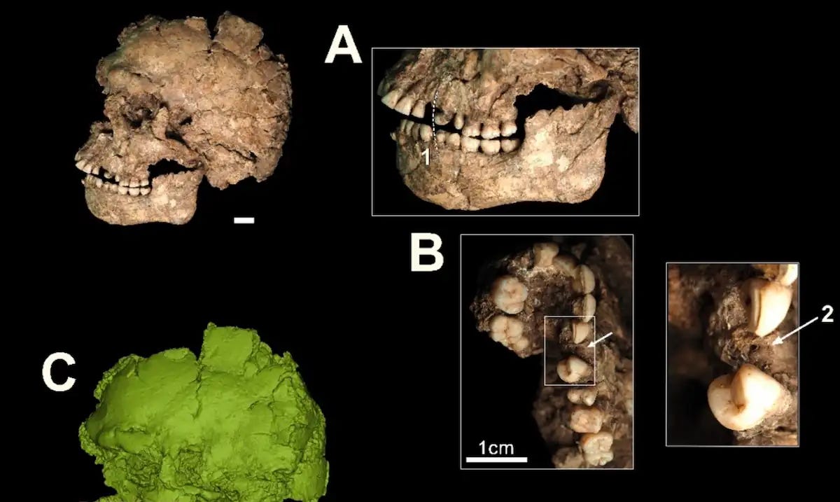 MicroCT analysis of the left maxillary region. (A) Three-dimensional reconstruction of the left mandibular and maxillary region showing the proposed trajectory of the traumatic injury (1). (B) Close-up of the root of the left upper canine (2), preserved in situ and still covered by sediment. (C) CT reconstruction highlighting fractures affecting the left maxillary dentition. Credit: A. Pantoja-Pérez et al., 2026.