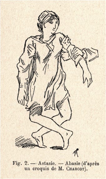 From hysteria to gait dementia: History of the concept of astasia-abasia -  ScienceDirect