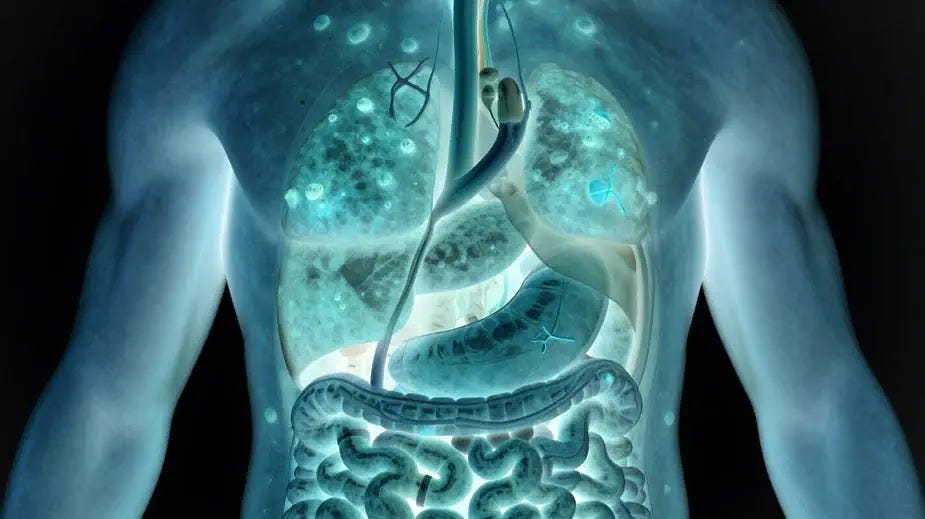 Medical illustration showing a human silhouette with visible skin lesions and internal organs affected by systemic inflammation, symbolizing that psoriasis impacts more than just the skin.