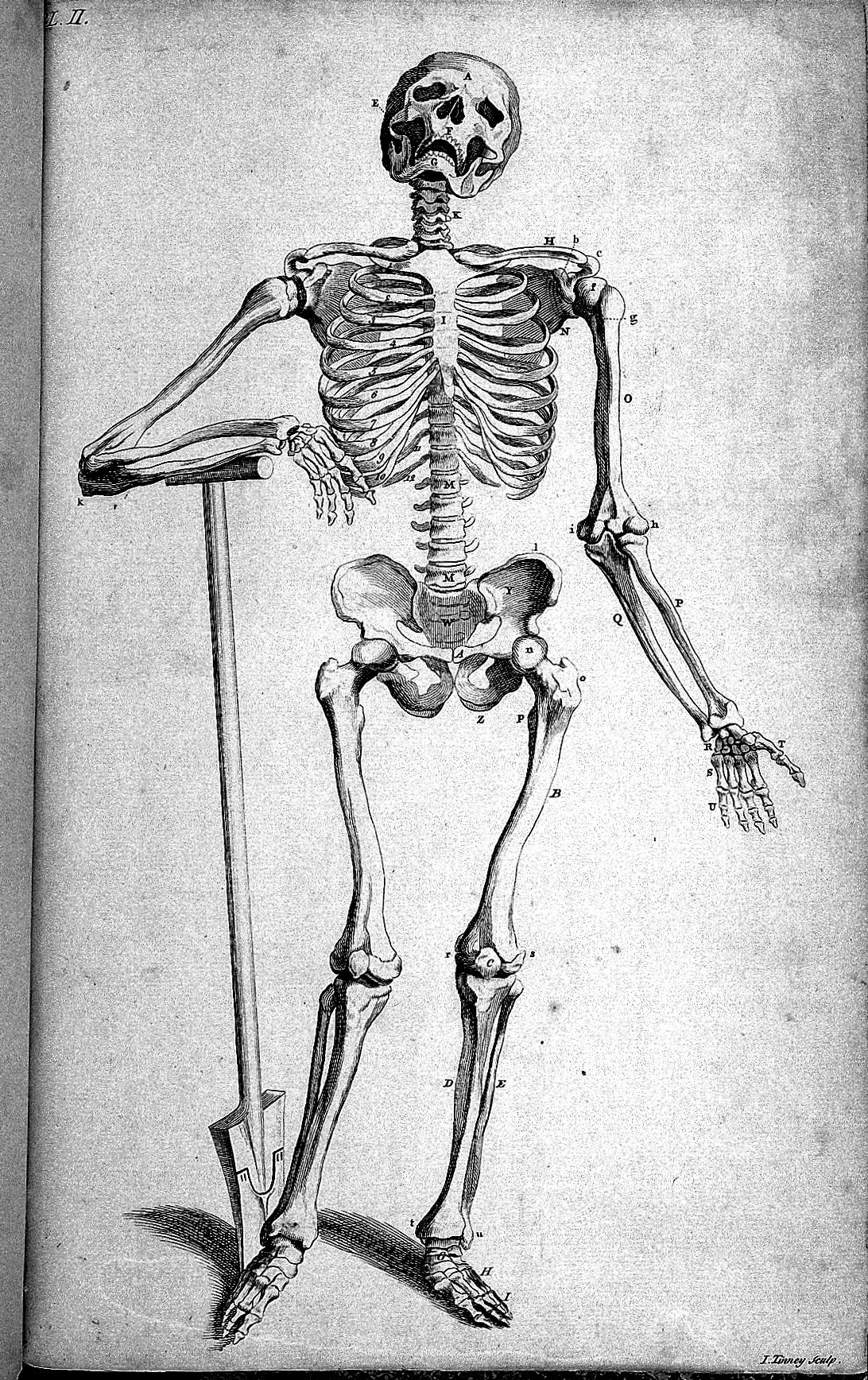 old medical textbook's drawing of a human skeleton, leaning on a crutch looking sad