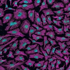 'Hallmarks of Aging' Series Part III: Nutrient Sensing, Mitochondrial Dysfunction, and Senescent Cells