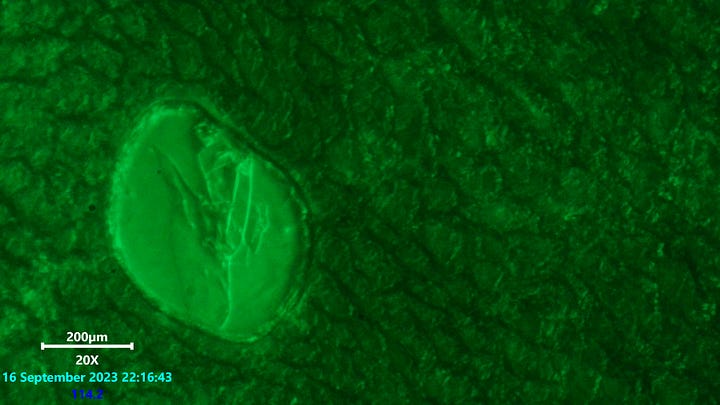 Laser scanning microscopy of ring constructor cell in blood. no remarkable activity observed applying 532nm laser. Right image is laser and white light source.