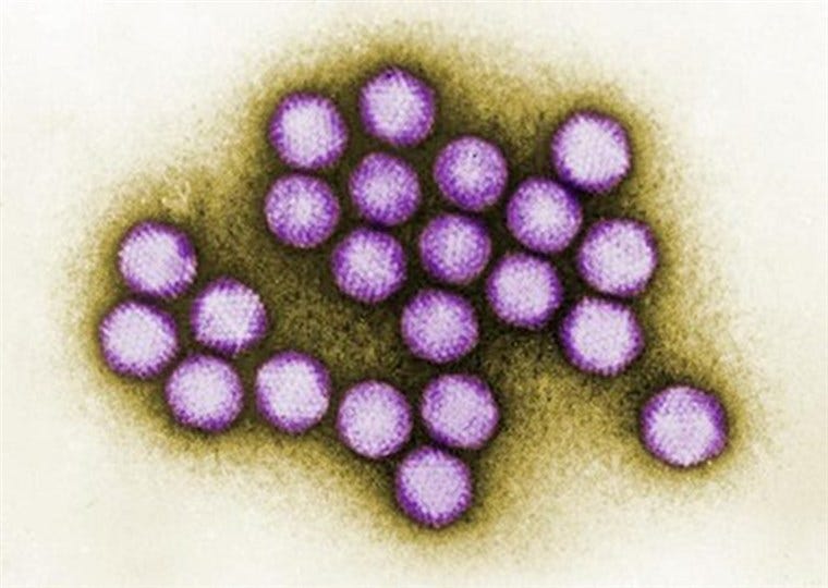 Image: Adenovirus transmission electron micrograph.