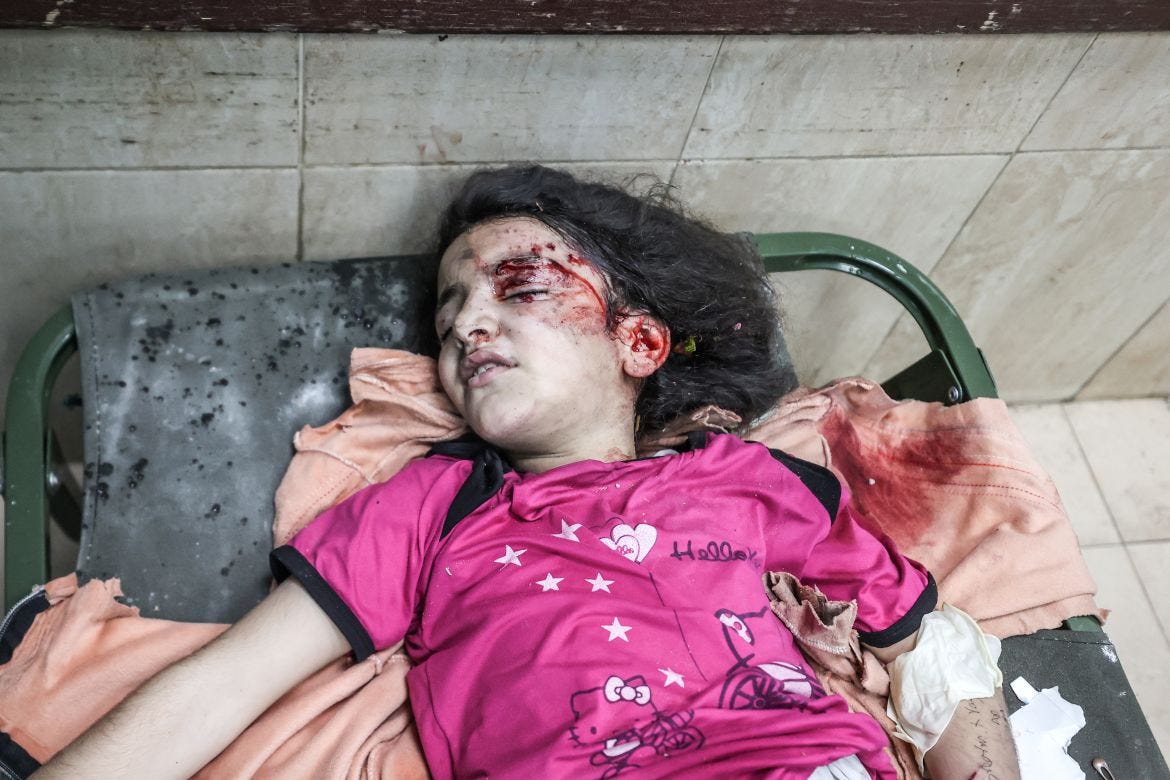 An injured Palestinian child is taken to the Al-Aqsa Martyrs Hospital for a treatment as Israeli attacks continue in Deir al-Balah, Gaza.