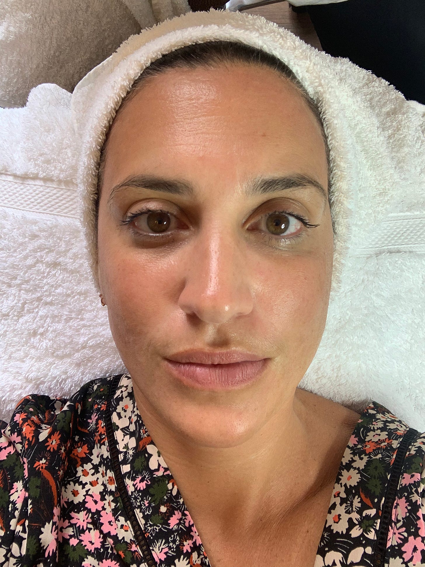 A high-angle, close-up portrait of beauty editor Donna during a professional facial treatment. Her hair is wrapped in a white towel, and her skin appears clear and radiant. This shot captures the "before" glow of a professional dermaplaning session.