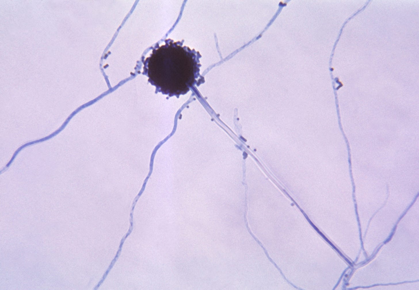 Aspergillus niger - Wikipedia
