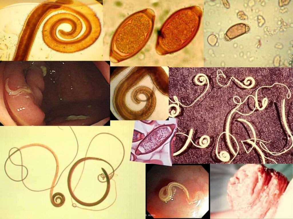 https://image.slidesharecdn.com/trichuris-trichiura-160226011651/95/trichuris-trichiura-11-1024.jpg?cb=1456449451