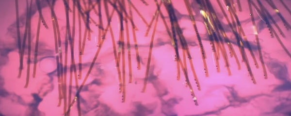 Just some Neuralink threads in a "brain."  (Credit Neuralink)